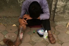 Bị đánh bầm dập vì giả hoại tử chân để ăn xin 