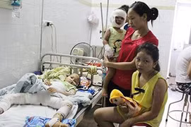 Phú Thọ: Đổ cồn nướng mực gần quạt, 3 trẻ bỏng nặng
