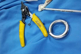 “Giải cứu của quý” của người đàn ông khỏi đồ chơi tình dục