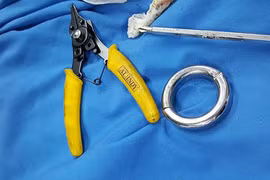 “Giải cứu của quý” của người đàn ông khỏi đồ chơi tình dục