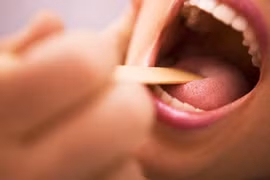 Đi khám ngay nếu có dấu hiệu ung thư vòm họng này 