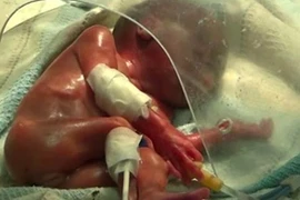 Kỳ diêu bé sơ sinh tỉnh lại khi sắp bị hỏa táng