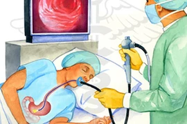 Gây mê để nội soi dạ dày: Lạm dụng "thần chết"