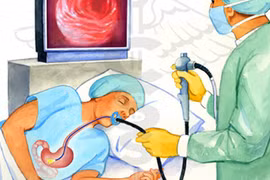 Gây mê để nội soi dạ dày: Lạm dụng "thần chết"