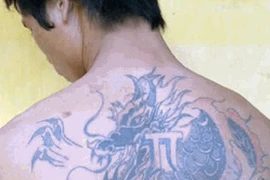 Trinh sát cải trang bác sĩ bắt sát thủ biệt danh 'máy chém'