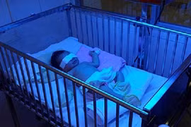 Quái gở mẹ cắn đứt ngón tay con gái 2 ngày tuổi