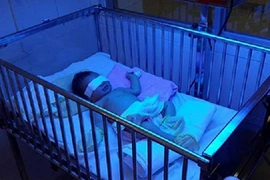 Quái gở mẹ cắn đứt ngón tay con gái 2 ngày tuổi