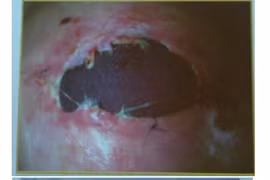 Nguyên tắc sống còn khi nâng ngực