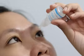 Cẩn trọng khi dùng nước muối sinh lý