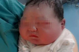 Ăn quá nhiều cháo, sản phụ sinh em bé khổng lồ nặng 6,6kg