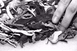 Suy thận giai đoạn 4 do dùng thuốc Nam bừa bãi