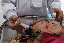 Trời lạnh, cho trẻ ngồi trước xe máy dễ bị liệt dây thần kinh số 7