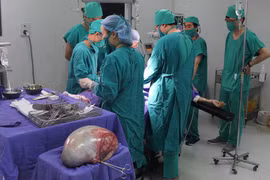 Phẫu thuật thành công khối u nang buồng trứng hơn 6,6 kg