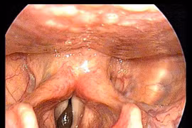 Đỉa bám chặt cổ họng người đàn ông và những vụ khó tin nhưng... có thật