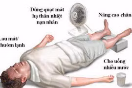 Bác sĩ mách cách đơn giản để sơ cứu người say nắng, say nóng tại chỗ
