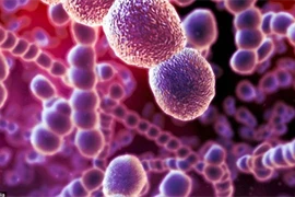 Cách đề phòng nhiễm vi khuẩn liên cầu lợn khi chế biến thực phẩm