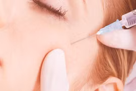 Bác sĩ phân tích rõ nguyên nhân tiêm filler thẩm mỹ lại mù mắt, đột quỵ?