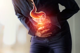 Ung thư đại tràng: Ai dễ mắc, triệu chứng thường gặp là gì?