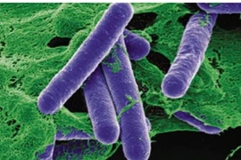 Các bác sĩ TP HCM điều trị bệnh nhân ngộ độc botulinum 