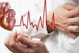 3 cách đơn giản nhận biết đột quỵ bạn cần nắm chắc