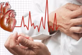 3 cách đơn giản nhận biết đột quỵ bạn cần nắm chắc