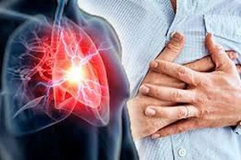 Hồi sinh tim phổi, cứu cụ bà 93 tuổi đã ngừng tim, ngừng thở ngoại viện