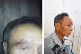 Công an bị "tố" vào nhà đánh người: Đại úy nói chỉ là "chuyện gia đình"