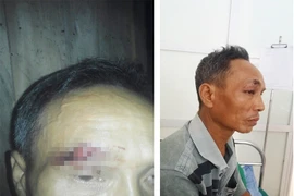 Công an bị "tố" vào nhà đánh người: Đại úy nói chỉ là "chuyện gia đình"