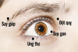 Video: Có dấu hiệu này ở mắt không khám ngay bạn sẽ hối hận cả đời