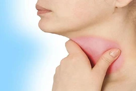 7 cách đơn giản để bảo vệ cổ họng, bạn biết chưa?