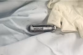 Bác sĩ lấy cục pin trong dạ dày bé trai 7 tuổi