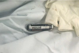 Bác sĩ lấy cục pin trong dạ dày bé trai 7 tuổi