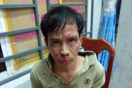 Gã đàn ông cầm mã tấu chém trọng thương thiếu tá công an phường