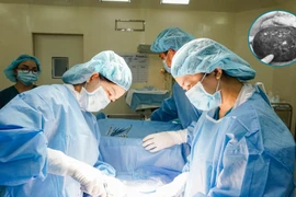 Đau bụng dữ dội, cơ thể tái xanh đi khám phát hiện u buồng trứng bị hoại tử to như quả bưởi