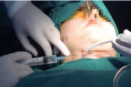 Spa “chui” tung hoành, dẹp mãi không hết: Chẳng lẽ “bó tay”?