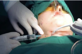 Spa “chui” tung hoành, dẹp mãi không hết: Chẳng lẽ “bó tay”?