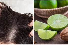 Tự ti vì tóc vừa gội đã bết dính, làm theo cách này bảo đảm 3-4 ngày tóc vẫn bồng bềnh như mây, sạch gàu