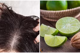 Tự ti vì tóc vừa gội đã bết dính, làm theo cách này bảo đảm 3-4 ngày tóc vẫn bồng bềnh như mây, sạch gàu