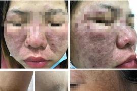 Chuyên gia Facebook, Tiktok dạy làm đẹp: Mạng ảo nhưng biến chứng là thật