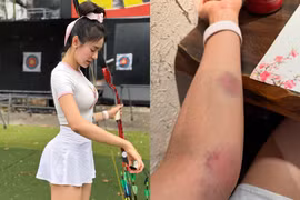 Thử sức với bắn cung, hot girl gym để lộ cánh tay bầm tím