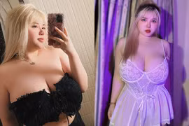 Hot girl Hải Dương từng phẫu thuật thu nhỏ vòng 1 giờ ra sao?