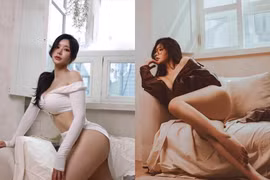 Đẹp lệch chuẩn, cô gái vẫn trở thành hot girl nổi tiếng Hàn Quốc