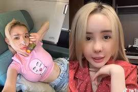 Netizen ngỡ ngàng với diện mạo khác lạ của Ngân 98 sau “dao kéo“