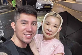 “Hot girl thị phi” Ngân 98 tiết lộ chi phí phẫu thuật thẩm mỹ