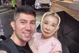 “Hot girl thị phi” Ngân 98 tiết lộ chi phí phẫu thuật thẩm mỹ