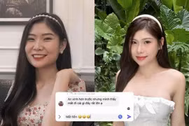 Nữ MC chịu chơi nhất làng Esports “sao kê” chi phí “đại phẫu” nhan sắc