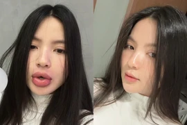 Netizen không nhận ra Chu Thanh Huyền sau khi phẫu thuật thẩm mỹ