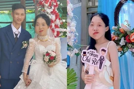 Cô gái mặt lệch từng bị chê ngoại hình, giờ chồng cưng hết mực