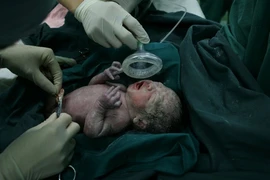 Cận cảnh ca mổ đẻ cho thai phụ sinh 4 gây sốt