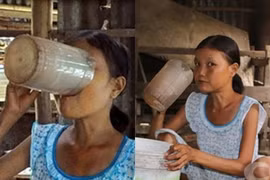 Nỗi thống khổ các thiếu nữ ăn uống vô độ như cô gái Quảng Nam